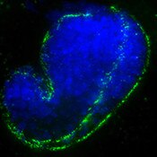IF of comma stage C. elegans stained with DSHB antibody MH5 against hypodermis (green). Image credit: DSHB.